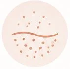 tratamientos-para-acne-unilasermedica
